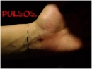 Pulses.